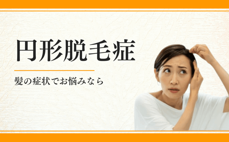 円形脱毛症