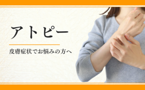 アトピー
