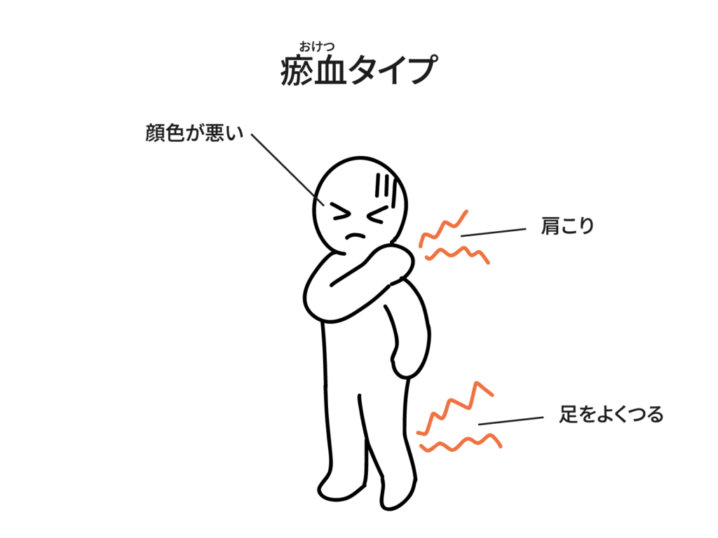 瘀血