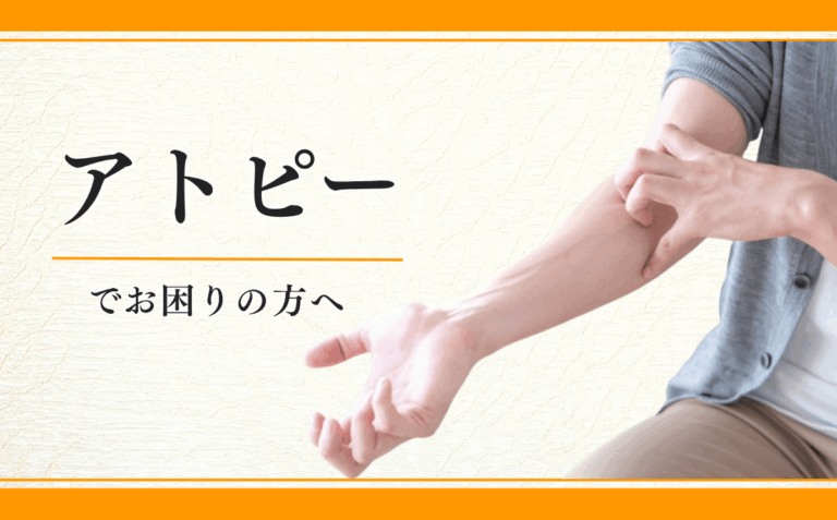 アトピー